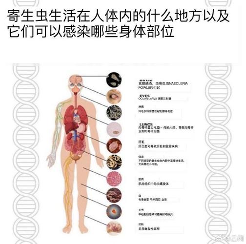 还在找内部寄生虫在哪下载?这里有详细教程!
